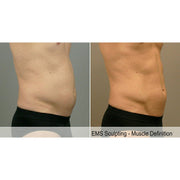 Tone Wave: EMS Body Sculpting