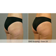 Tone Wave: EMS Body Sculpting