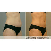 Tone Wave: EMS Body Sculpting