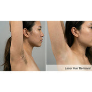 DermaLux: 808nm Diode Laser