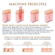 Skin Monarch Quantum Pro Diode & Picosecond Laser